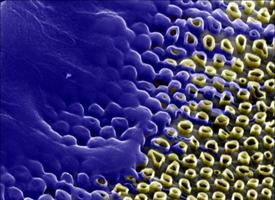 Electron microscopic image of animal cells on array of nanotubes